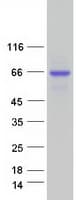 Human ALPL / Alkaline Phosphatase Protein (Recombinant Myc-DDK (Flag))