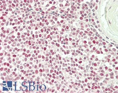 PathPlus™ BMI1 / PCGF4 Antibody (aa276-326)