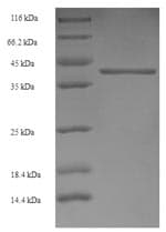Human GABRA4 Protein (Recombinant 6His-SUMO, N-terminus)