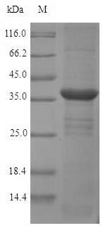 Rat MGLL / Monoacylglycerol Lipase Protein (Recombinant 6His, N-terminus)