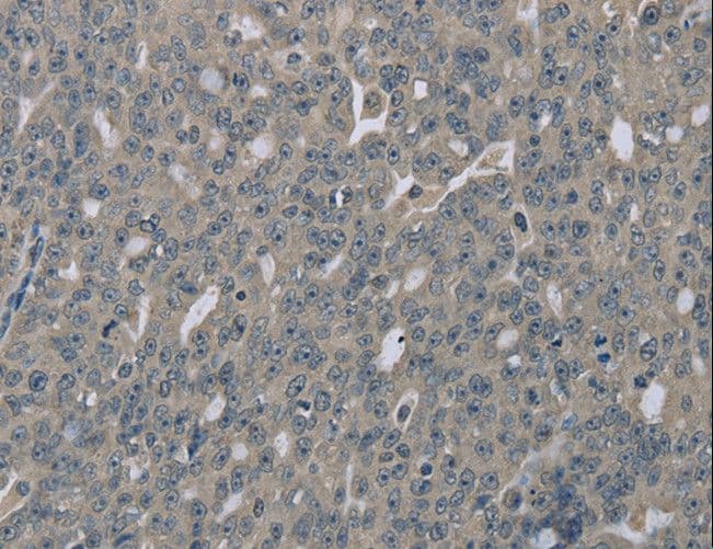 Polyclonal Rabbit anti-Human EDN1 / Endothelin 1 Antibody (IHC)