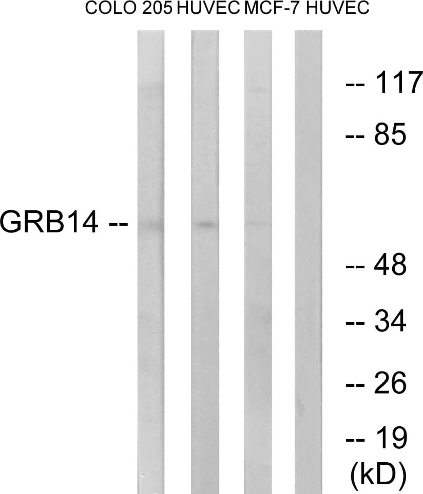 Polyclonal Rabbit anti-Human GRB14 Antibody (aa81-130, WB)