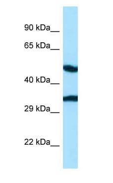 Polyclonal Rabbit anti-Human CASQ2 / Calsequestrin 2 Antibody (aa32-81, WB)