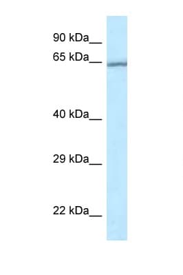 RASGRP4 Antibody (aa149-198)