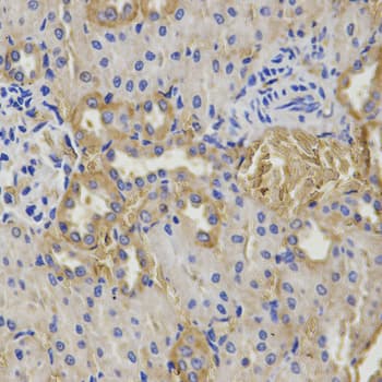 IHC-plus™ GSS / Glutathione Synthetase Antibody