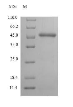 Streptococcus pyogenes CTPS Protein (Recombinant 10His-SUMO, N-terminus + Myc, C-terminus)