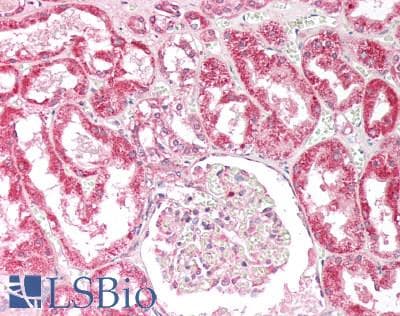 IHC-plus™ OSBPL5 Antibody (aa2-14)