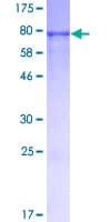 Human IRF3 Protein (Recombinant GST)