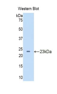 SEMA5B / Semaphorin 5B Antibody (aa836-1013, PE)
