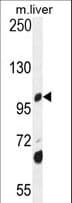 DHTKD1 Antibody (aa392-421)