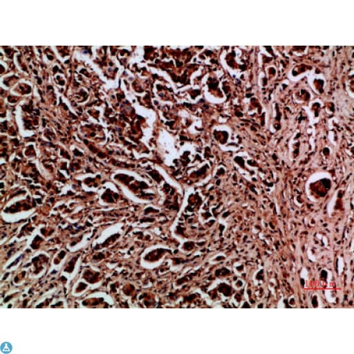 HDGF Antibody