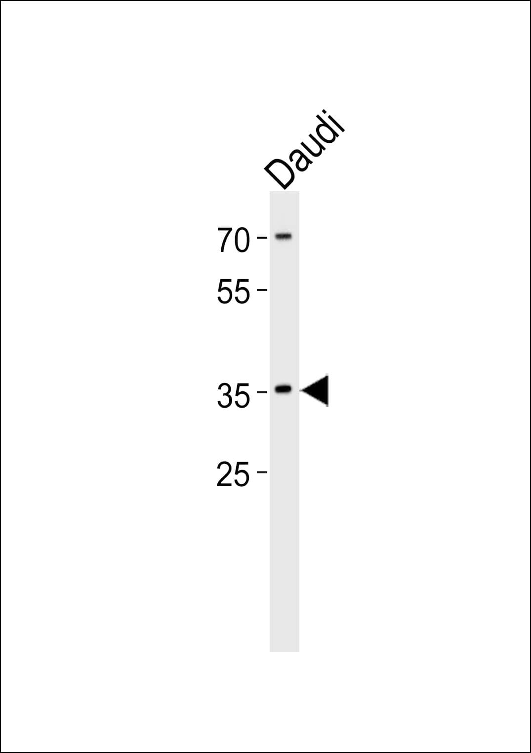 FOSL2 / FRA-2 Antibody (aa95-122)