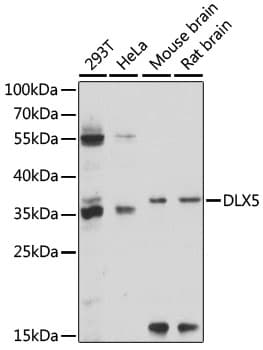 Polyclonal Rabbit anti-Human DLX5 Antibody (WB)