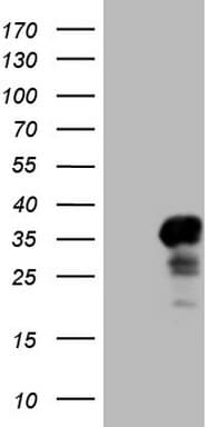 CITED1 Antibody (clone OTI2H7)