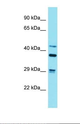 STRN3 Antibody (aa78-127)