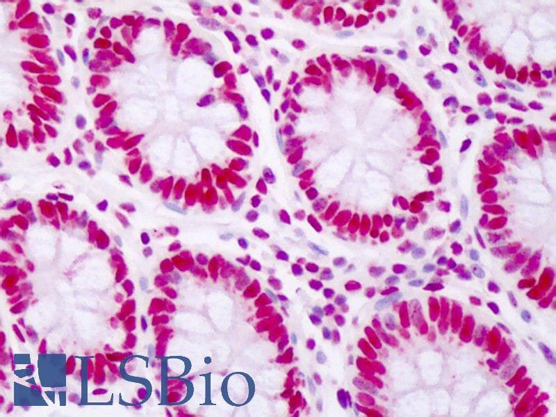 IHC-plus™ KHDRBS1 / SAM68 Antibody (aa331-348)