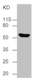 TP53 / p53 Antibody (clone 6H5E7)