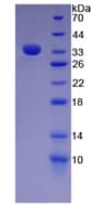 Human FN1 / Fibronectin Protein (Recombinant His, N-Terminal)