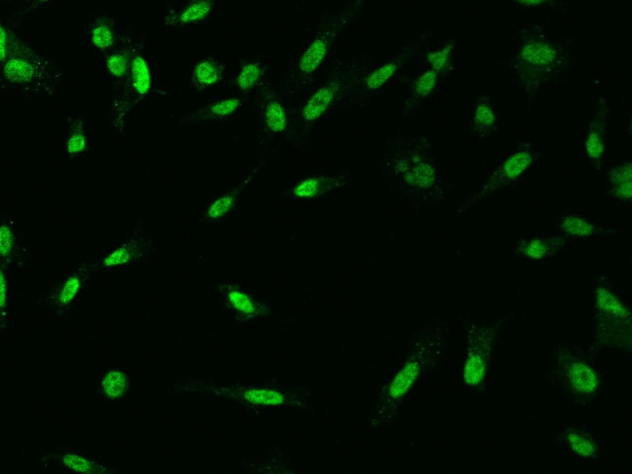MYST2 / HBO1 Antibody