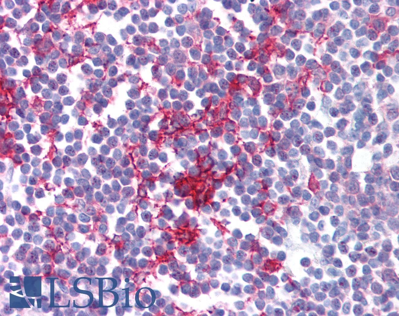 IHC-plus™ Polyclonal Rabbit anti-Human ER Alpha / Estrogen Receptor Antibody (phospho-Ser104/Ser106, IHC)