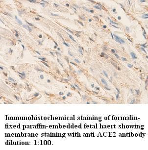 ACE2 / ACE-2 Antibody (N-Terminus)
