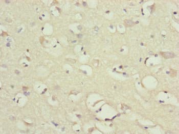 NDUFB10 Antibody