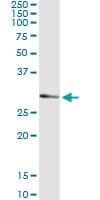 UCK2 Antibody (clone 1G12)