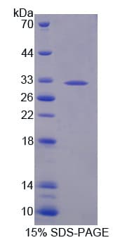 Mouse TYK2 Protein (Recombinant His-T7)