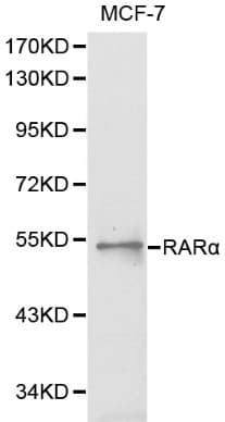 Polyclonal Rabbit anti-Human BLMH Antibody (IHC, WB)