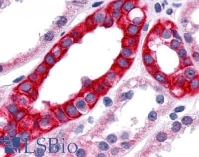 PathPlus™ TNIK Antibody (Internal)