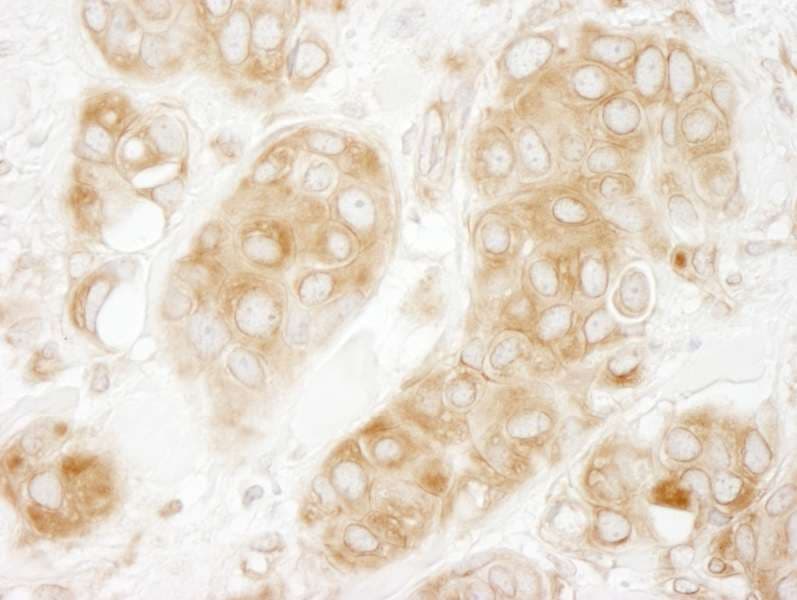 GIT1 Antibody (aa375-425)