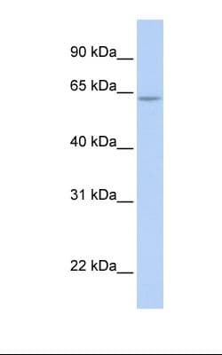 ARID5A Antibody (aa110-159)