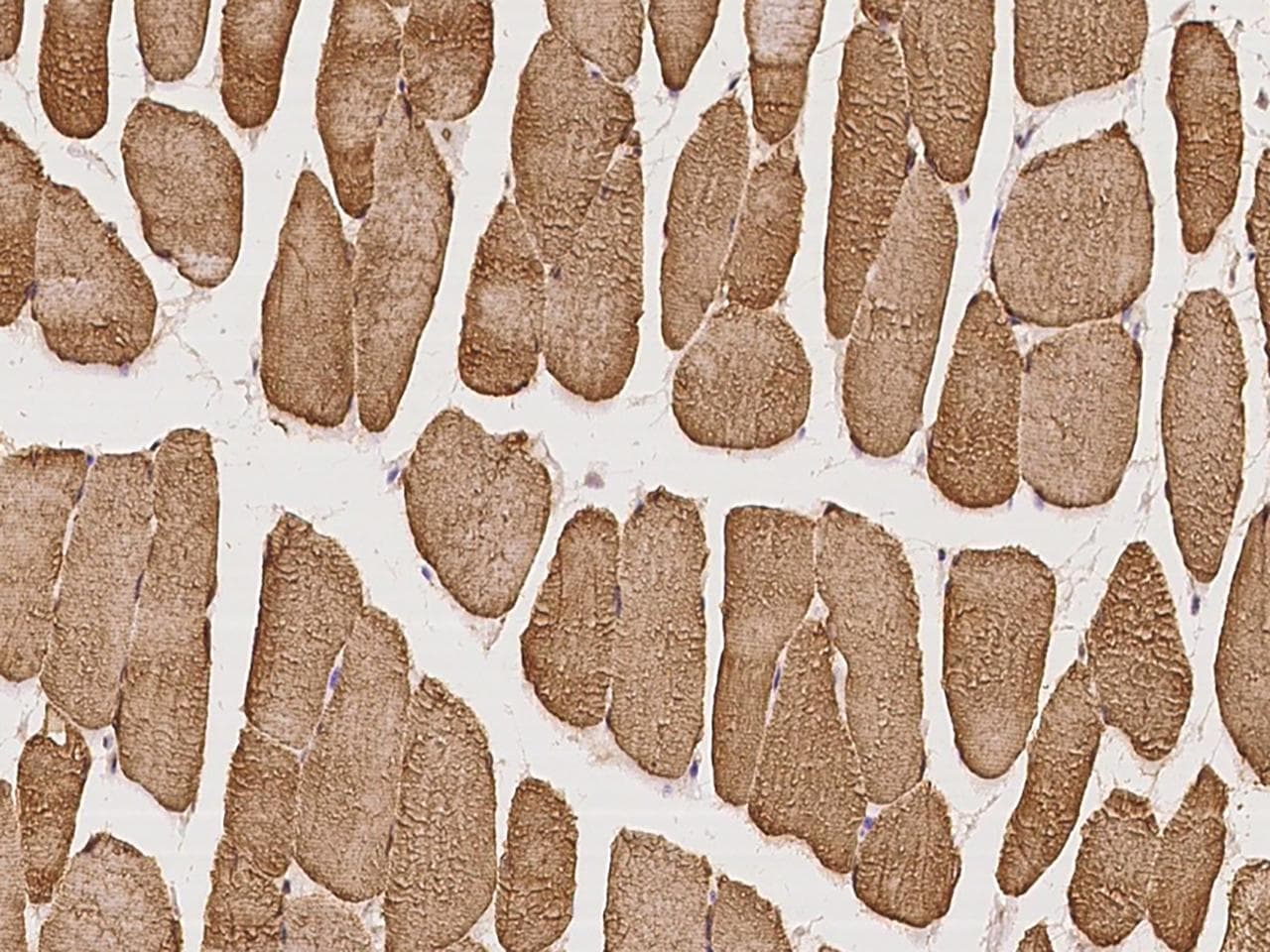 BTF3L4 Antibody