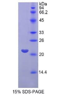 Human FGF13 Protein (Recombinant His)