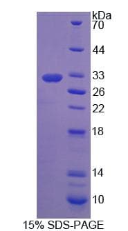 Mouse PTGFRN Protein (Recombinant His, N-Terminal)