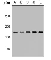 Polyclonal Rabbit anti-Human ARHGAP5 / RhoGAP5 Antibody (WB)