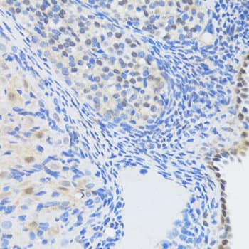Polyclonal Rabbit anti-Human EP300 / p300 Antibody (IHC, WB)