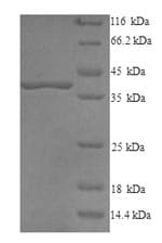 Cow DCN / Decorin Protein (Recombinant 6His, N-terminus)