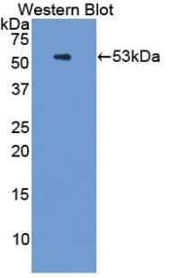 PSMC3 Antibody (aa2-439)