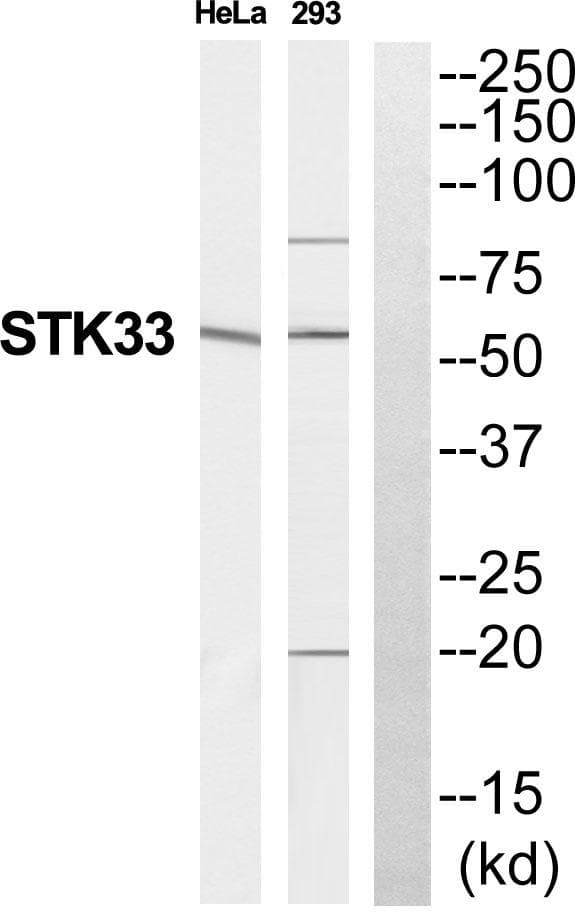 STK33 Antibody