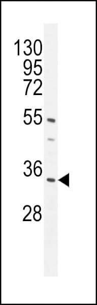 Polyclonal Rabbit anti-Human C18orf25 / ARKL1 Antibody (aa163-191, IHC, WB)