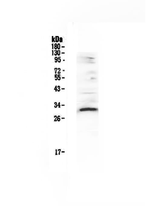 VEGFB Antibody
