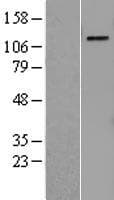Human PRPF4B Protein (Over-Expression Lysate Myc-DDK (Flag))