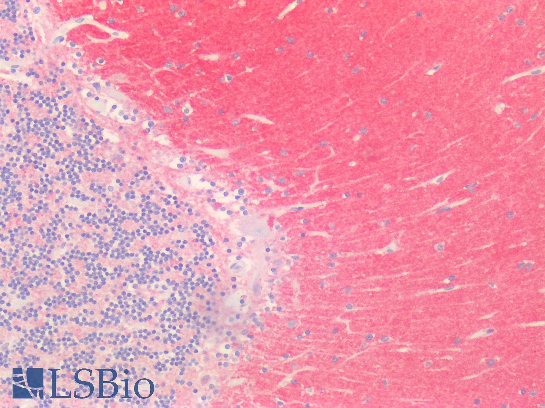 PathPlus™ SYN1 / Synapsin 1 Antibody (aa113-420)
