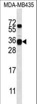 CSN2 / Beta Casein Antibody (aa25-54)