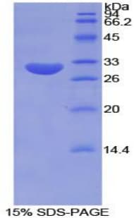 Mouse TUBE1 / Tubulin Epsilon Protein (Recombinant His-T7)