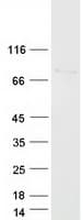 Human UROC1 Protein (Recombinant Myc-DDK (Flag))
