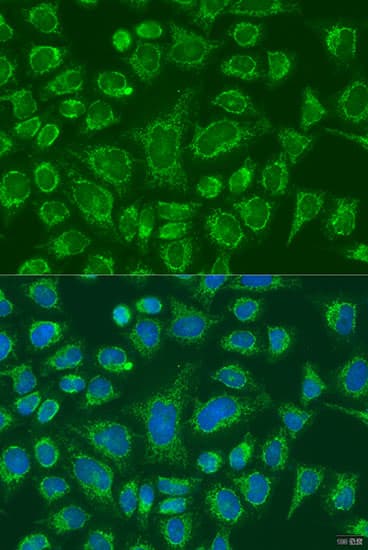FCGR3B / CD16B Antibody