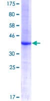 Human KIF20B Protein (Recombinant GST, N-terminus)