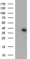 Monoclonal Mouse anti-Human MCAT Antibody (clone OTI2B7, WB)